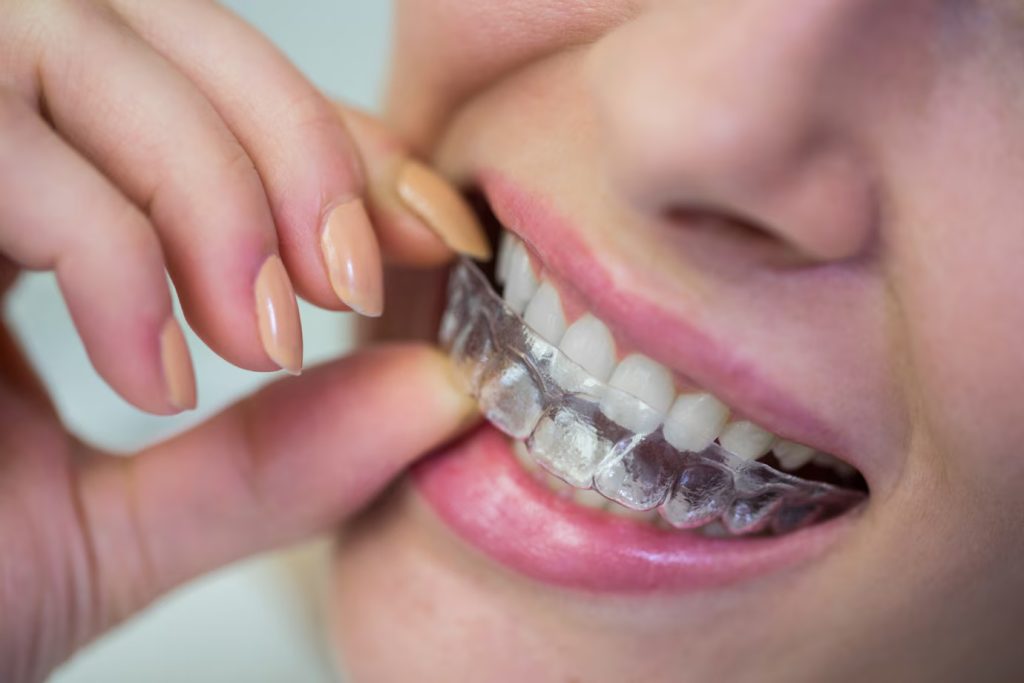 Discovering Excellence in Dental Care at Mason Park Dental of Katy