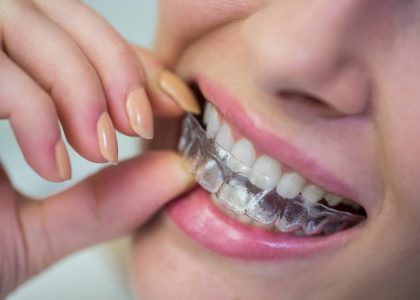Invisalign