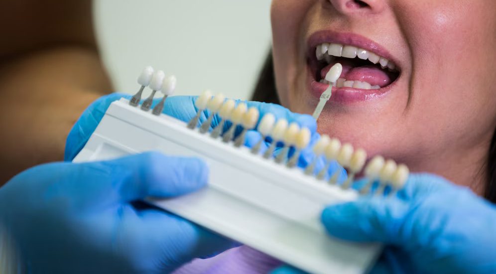 Cosmetic Dentistry